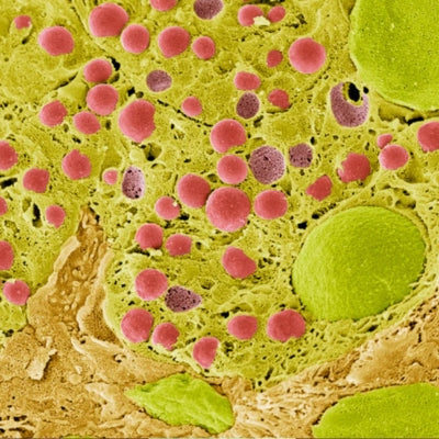 Fungal Lipase + Fungal Lactase1500 FIP + 600 LACU